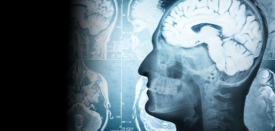 Northumbria University students analysing a brain scan as part of their degree