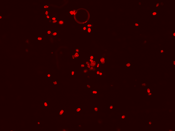 a group of fireworks in the sky