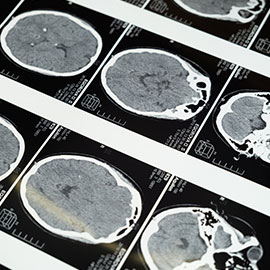 A close up picture of a brain scan