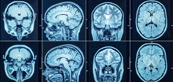 Blue image of brain scans